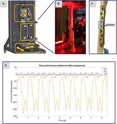 Experimental and virtual testing of bone-implant systems equipped with the AO Fracture Monitor with regard to interfragmentary movement